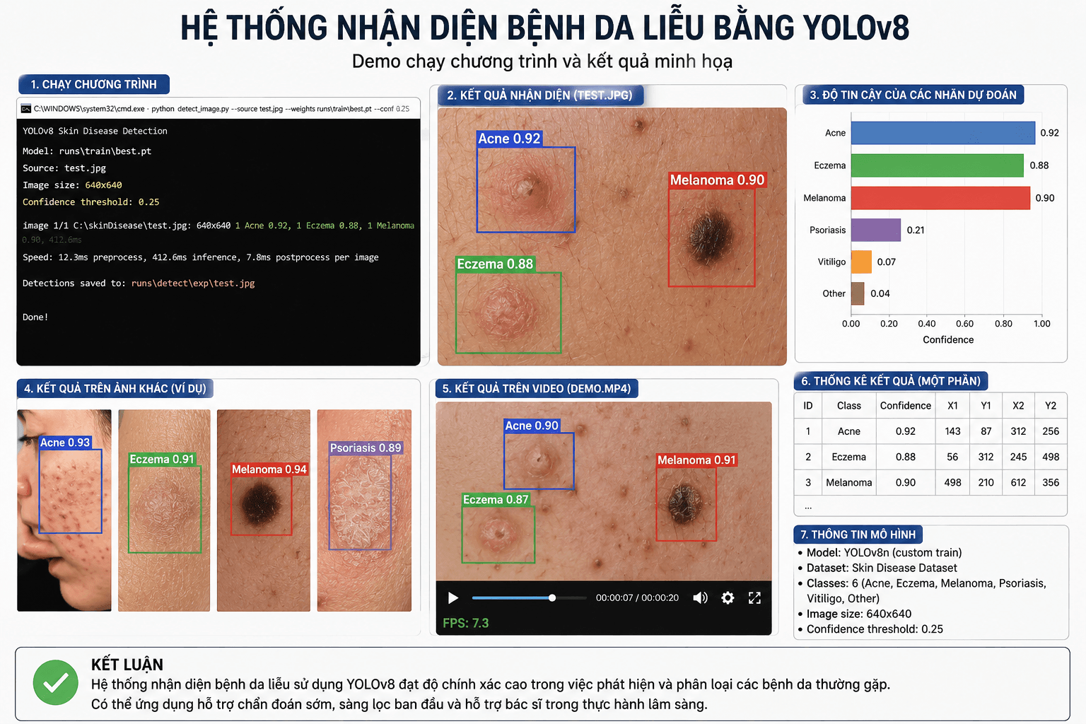 skinDisease classifier with Grad-CAM explanation